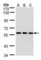 mRNA-capping enzyme antibody, TA308288, Origene, Western Blot image 