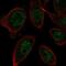 Zinc Finger Protein 664 antibody, NBP2-56858, Novus Biologicals, Immunocytochemistry image 