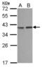 Carbonic Anhydrase 8 antibody, NBP2-15657, Novus Biologicals, Western Blot image 