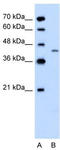 Dihydroorotate Dehydrogenase (Quinone) antibody, TA346290, Origene, Western Blot image 