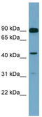 Diacylglycerol Kinase Alpha antibody, TA337619, Origene, Western Blot image 