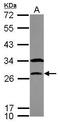 PTTG1 antibody, GTX111938, GeneTex, Western Blot image 
