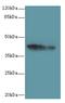 Uracil nucleotide/cysteinyl leukotriene receptor antibody, A59290-100, Epigentek, Western Blot image 