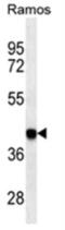 HLA class I histocompatibility antigen, B-55 alpha chain antibody, NBP2-41437, Novus Biologicals, Western Blot image 