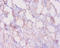 BCL2 antibody, LS-C285466, Lifespan Biosciences, Immunohistochemistry paraffin image 