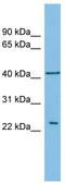 Ras-related protein Ral-B antibody, TA342185, Origene, Western Blot image 