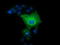 L1 Cell Adhesion Molecule antibody, LS-C115427, Lifespan Biosciences, Immunofluorescence image 