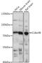 Regulator Of MON1-CCZ1 antibody, A31818, Boster Biological Technology, Western Blot image 