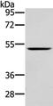 WASP Family Member 2 antibody, TA351922, Origene, Western Blot image 