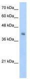 V-set and immunoglobulin domain-containing protein 4 antibody, TA346124, Origene, Western Blot image 