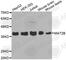 Methionine Adenosyltransferase 2B antibody, A3421, ABclonal Technology, Western Blot image 