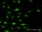 Fanconi anemia group F protein antibody, H00002188-B01P, Novus Biologicals, Immunocytochemistry image 