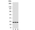 Thy-1 Cell Surface Antigen antibody, R30589, NSJ Bioreagents, Western Blot image 