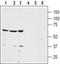 Neurotensin receptor type 1 antibody, TA328679, Origene, Western Blot image 