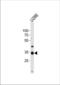 NK3 Homeobox 2 antibody, TA324621, Origene, Western Blot image 