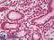 Cyclin D1 antibody, LS-B8680, Lifespan Biosciences, Immunohistochemistry paraffin image 