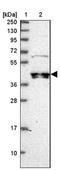 Ciliogenesis Associated TTC17 Interacting Protein antibody, NBP1-91729, Novus Biologicals, Western Blot image 