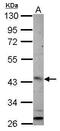 ADP Ribosylation Factor Like GTPase 13B antibody, PA5-32035, Invitrogen Antibodies, Western Blot image 