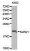 Killer Cell Lectin Like Receptor D1 antibody, LS-C192814, Lifespan Biosciences, Western Blot image 