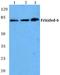 Frizzled Class Receptor 6 antibody, A04241T167, Boster Biological Technology, Western Blot image 