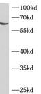 Adenosine Deaminase Domain Containing 2 antibody, FNab00136, FineTest, Western Blot image 