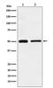 Kim1 antibody, M01306, Boster Biological Technology, Western Blot image 