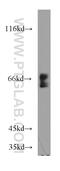 UBX Domain Protein 4 antibody, 21052-1-AP, Proteintech Group, Western Blot image 