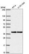 Mitochondrial Fission Regulator 1 antibody, HPA056120, Atlas Antibodies, Western Blot image 