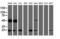 Ubiquitin Conjugating Enzyme E2 E3 antibody, LS-C788613, Lifespan Biosciences, Western Blot image 
