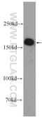 GRB10 Interacting GYF Protein 2 antibody, 24790-1-AP, Proteintech Group, Western Blot image 