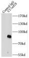 UPF0663 transmembrane protein C17orf28 antibody, FNab01040, FineTest, Immunoprecipitation image 