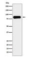 Aconitase antibody, M03096-2, Boster Biological Technology, Western Blot image 