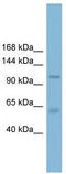 Chloride Channel Accessory 2 antibody, TA338561, Origene, Western Blot image 
