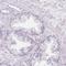 SET And MYND Domain Containing 1 antibody, HPA062282, Atlas Antibodies, Immunohistochemistry frozen image 