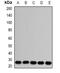 RAB17, Member RAS Oncogene Family antibody, abx142182, Abbexa, Western Blot image 