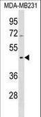 Septin 12 antibody, LS-C158941, Lifespan Biosciences, Western Blot image 