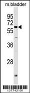 Glucose 1,6-bisphosphate synthase antibody, 59-741, ProSci, Western Blot image 