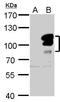 L3MBTL Histone Methyl-Lysine Binding Protein 1 antibody, GTX115782, GeneTex, Western Blot image 