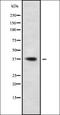 C-C chemokine receptor type 10 antibody, orb336389, Biorbyt, Western Blot image 