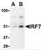 Interferon regulatory factor 7 antibody, 3943, ProSci Inc, Western Blot image 