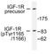 Insulin Like Growth Factor 1 Receptor antibody, AP01611PU-N, Origene, Western Blot image 