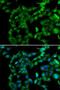 Protein Kinase AMP-Activated Non-Catalytic Subunit Beta 2 antibody, LS-C748394, Lifespan Biosciences, Immunofluorescence image 