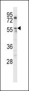 Lipoprotein lipase antibody, 57-531, ProSci, Western Blot image 