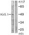 Potassium Voltage-Gated Channel Subfamily J Member 16 antibody, LS-B9865, Lifespan Biosciences, Western Blot image 