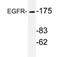 EGFR antibody, AP20707PU-N, Origene, Western Blot image 