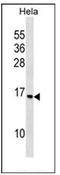40S ribosomal protein S14 antibody, AP53734PU-N, Origene, Western Blot image 