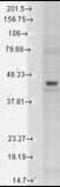Potassium Voltage-Gated Channel Subfamily J Member 4 antibody, orb95885, Biorbyt, Western Blot image 