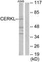 Ceramide Kinase Like antibody, GTX87803, GeneTex, Western Blot image 