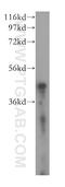 Sterol O-acyltransferase 1 antibody, 16215-1-AP, Proteintech Group, Western Blot image 
