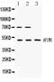 AP-2 complex subunit mu antibody, LS-C662243, Lifespan Biosciences, Western Blot image 